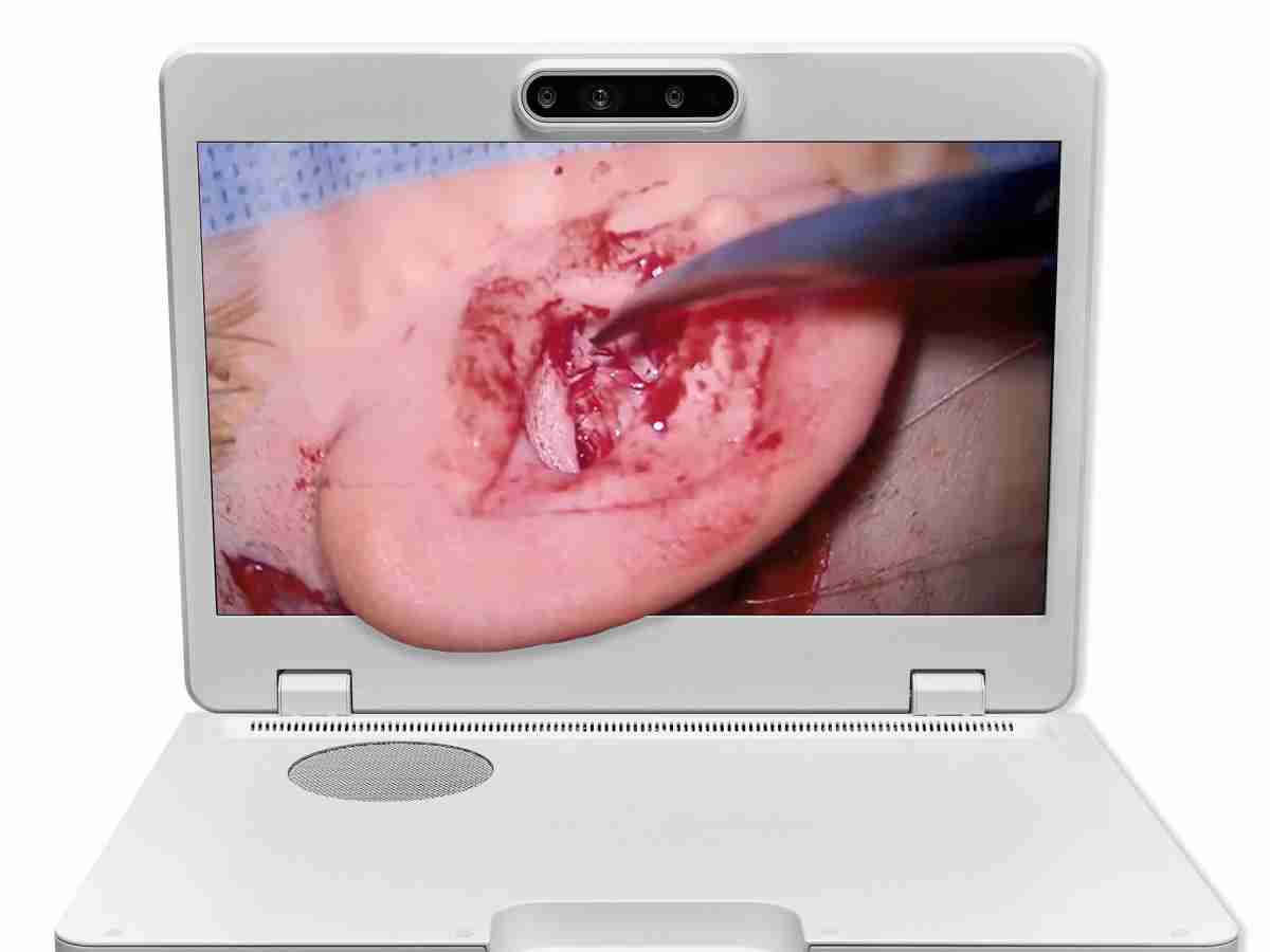 达擎之＂Heads-up 3D显微手术显示系统＂，，，，整合4K裸眼3D显示及眼球追踪系统，，具备快速追踪人眼移动位置功能，，，，减轻医师长时间维持固定姿势的负担，，让医师能有更宽广清晰的3D立体视野及更舒适的姿势来执行手术。。